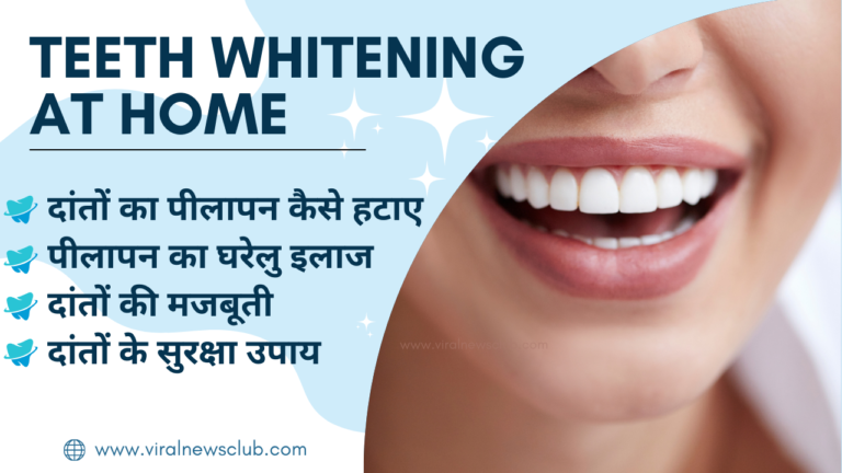 TEETH WHITENING AT HOME
