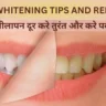 TEETH WHITENING TIPS AND REMEDIES